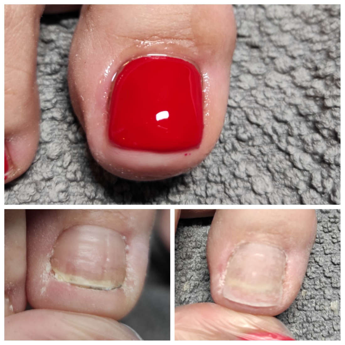 Pedicure leczniczy w Gabinecie Kosmetyczno-Podologicznym Maria